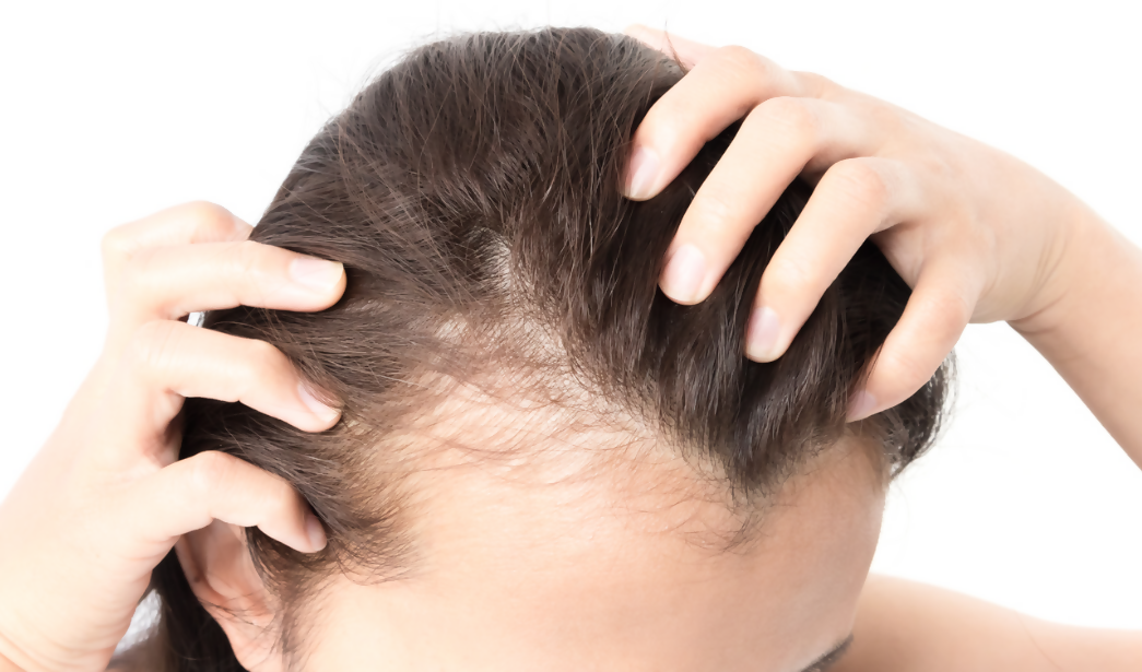 Hair Transplantation