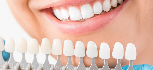 Dental Veneers